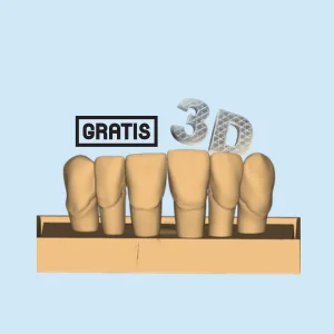 Archivo STL de carillas 3D imprimible